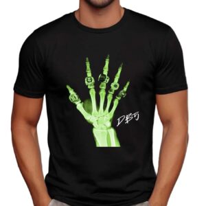 Patient 5 Damon Karma Barlow metacarpals t shirt